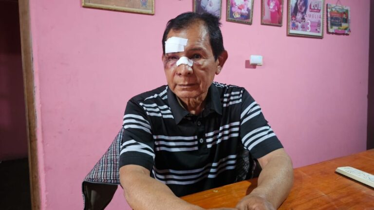 Empleados de un boliche le dieron una brutal golpiza a un hombre de 71 años